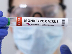 我国研发的猴痘病毒核酸检测试剂盒获欧盟CE认证