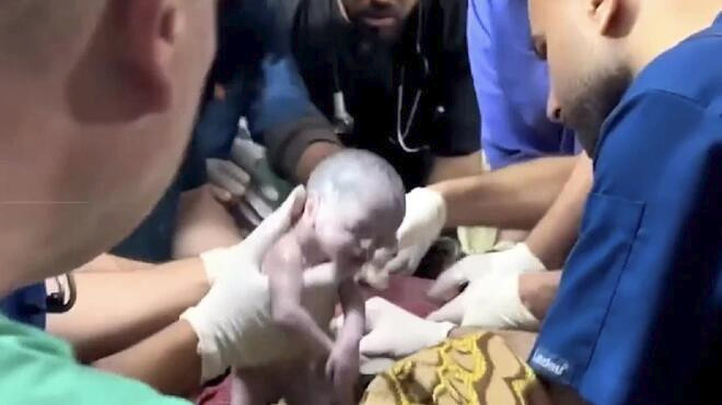 加沙孕妇遭空袭身亡 紧急剖宫产女婴获救