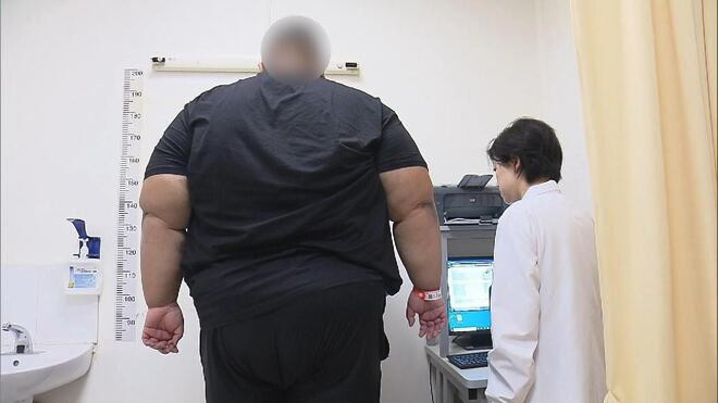 上海30岁小伙BMI超70 华东医院多学科联合手术