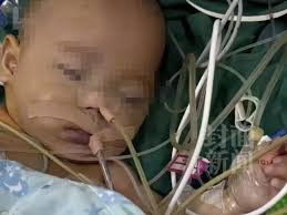 宁波通报患儿术后离世情况调查 医疗团队对手术风险评估不足 手术操作存过失