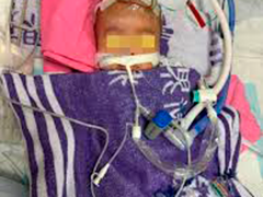 香港两名外籍女佣涉嫌虐待幼童被拘捕 4个月男婴情况危殆 16个月兄长同遭虐待