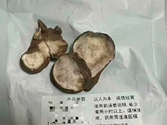 网购中药自行服用藏风险 35岁男子附子中毒