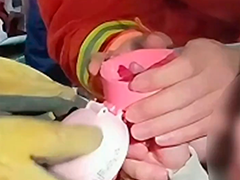 女童手指卡杯盖 消防巧解"紧箍咒"